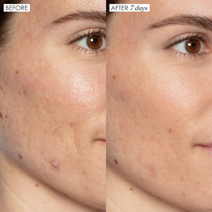 Good Genes All-In-One AHA Lactic Acid Treatment-Jumbo size 50ml