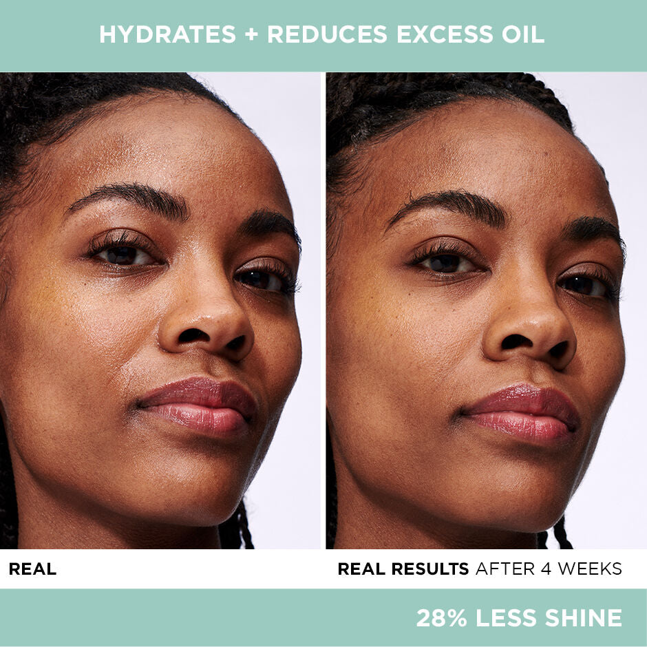 IT BEATS OIL + BOOSTS HYDRATION FOR BALANCED SKIN!