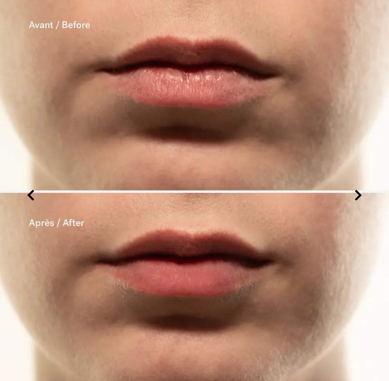 L72 - Repairing Lip Mask
1% Ceramides + Hyaluronic Acid- Very powerful