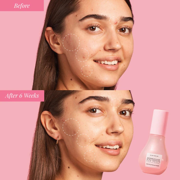 Watermelon Glow Niacinamide-Choose your fav!