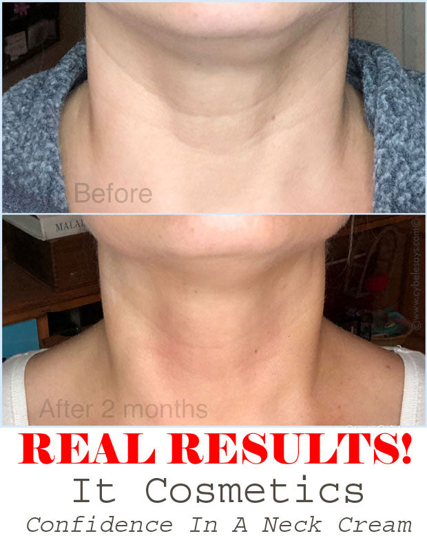 Confidence in a Neck Cream Moisturizer