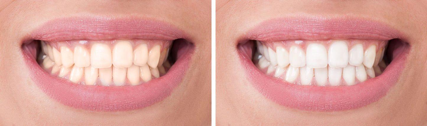 2 teeth whitening pens