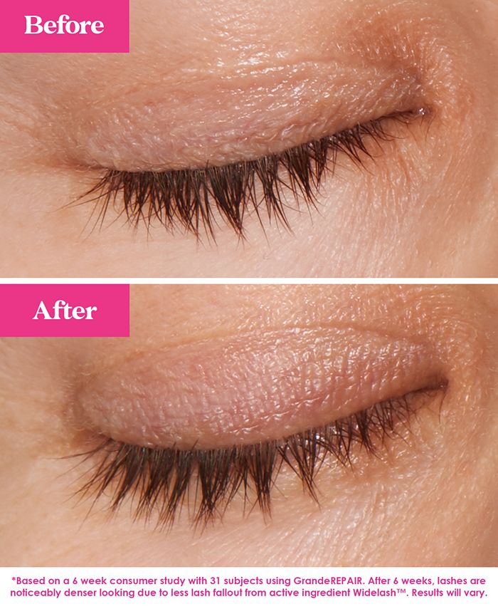 Lash Fix-It Starter Kit