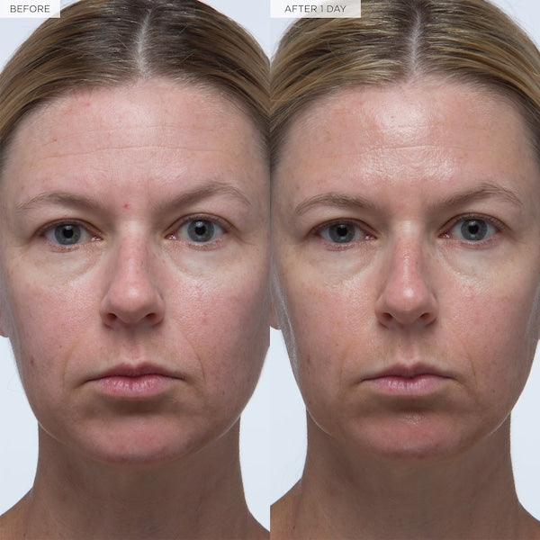Plum Plump™ Hyaluronic Acid Serum Full/mini size