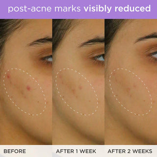 Brightening & Firming Vitamin-C Serum