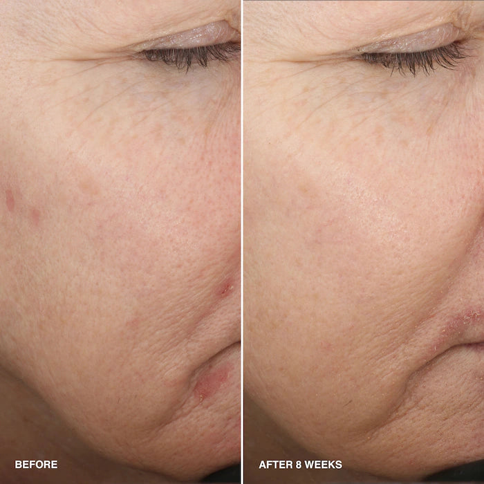 Vitamin Enriched Smoothing Serum with Niacinamide + Vitamin C
