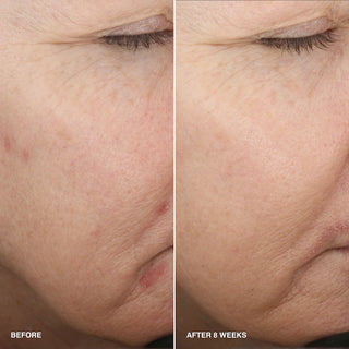 Vitamin Enriched Smoothing Serum with Niacinamide + Vitamin C