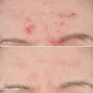 Vitamin Enriched Smoothing Serum with Niacinamide + Vitamin C