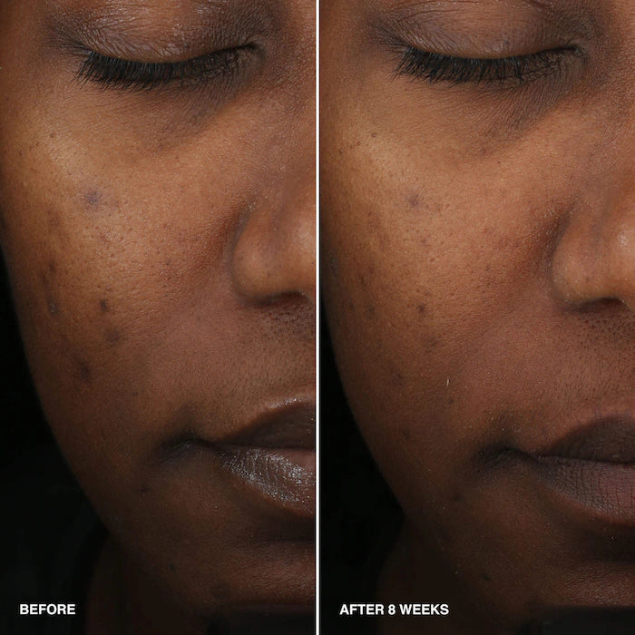 Vitamin Enriched Smoothing Serum with Niacinamide + Vitamin C