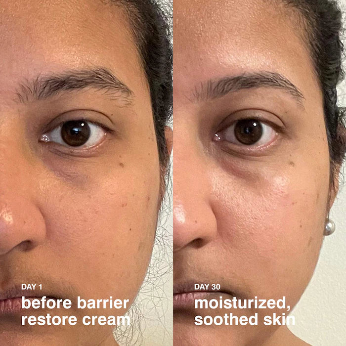 Mini Barrier Restore Cream Comforting Daily Moisturizer-30ml