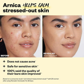 Revealer Super Creamy + Brightening Concealer with Caffeine and Hyaluronic Acid-Tone 04 N - light medium with neutral yellow undertones