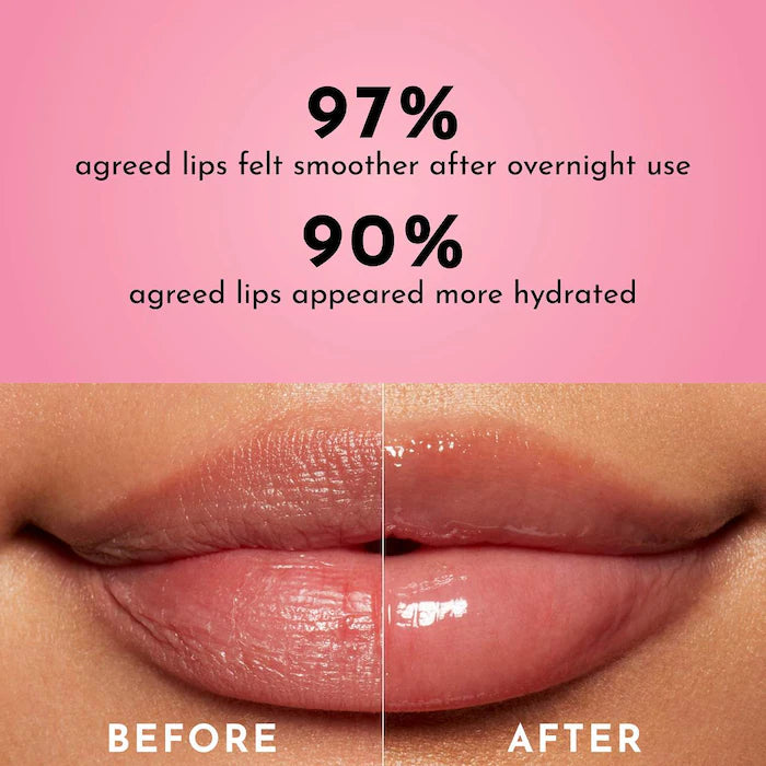 Forget The Filler Overnight Lip Plumping Mask-Sweet dreams