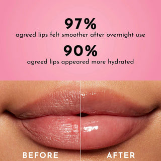 Forget The Filler Overnight Lip Plumping Mask-Sweet dreams