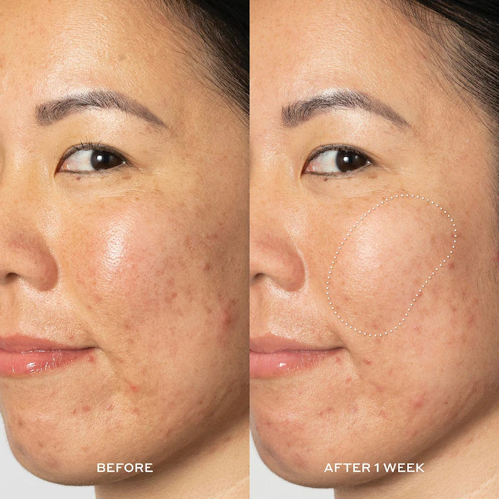 Glow2OH Exfoliating Dark Spot Toner with Glycolic & Lactic Acid
