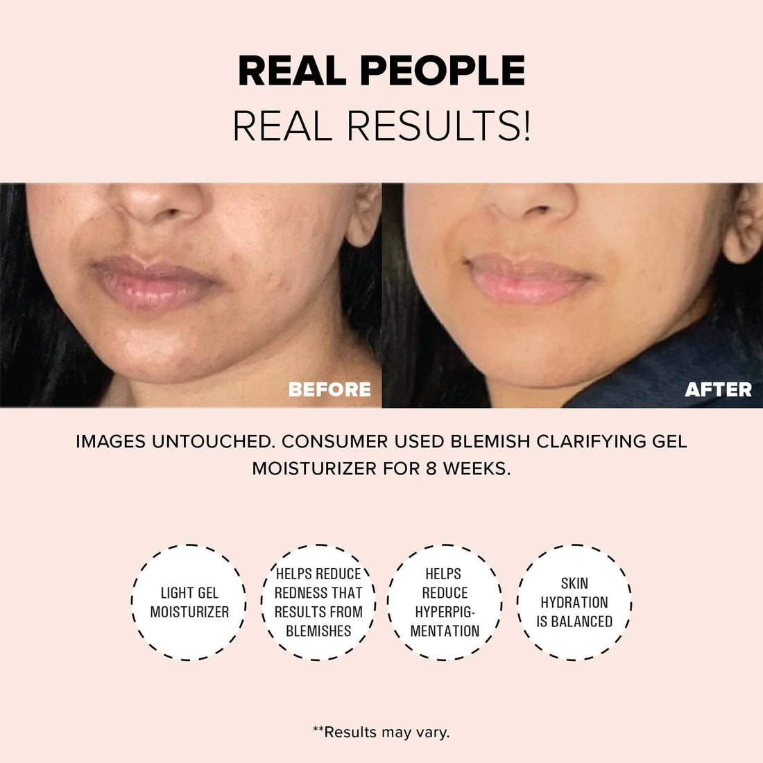 Blemish Clarifying Gel Moisturizer
2% SALICYLIC ACID + 2.5% NIACINAMIDE