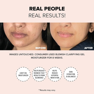 Blemish Clarifying Gel Moisturizer
2% SALICYLIC ACID + 2.5% NIACINAMIDE