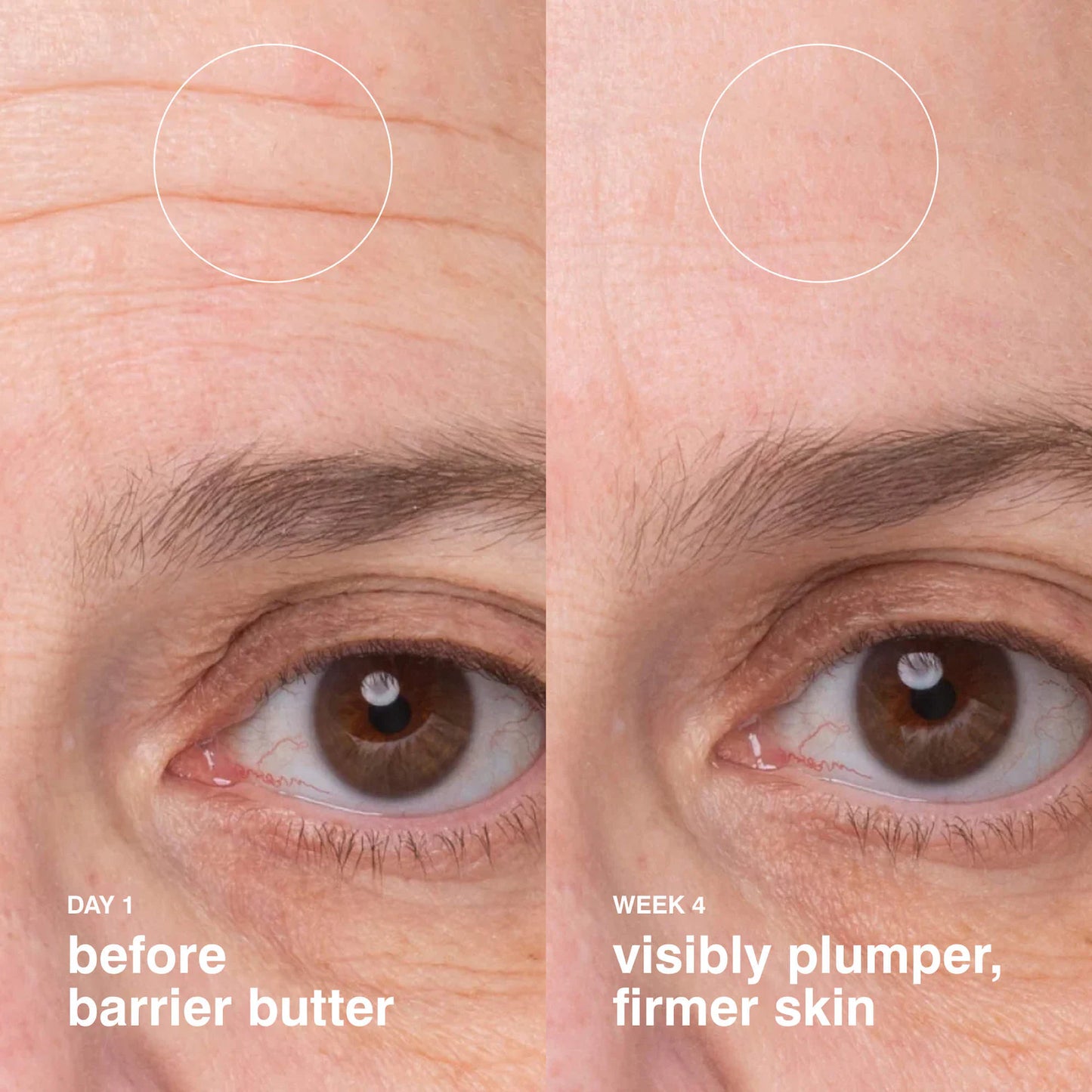 Barrier Butter Intensive Moisturizing Balm-40ML