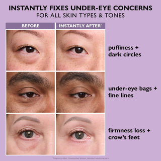Instant FIRMx® Eye Temporary Eye Tightener Easy-Wear Formula for Firming Under-Eye Bags & Wrinkles