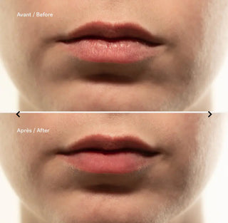 L72 - Repairing Lip Mask
1% Ceramides + Hyaluronic Acid- Very powerful