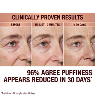 CHARLOTTE'S HOLLYWOOD SKIN SECRETS IMMEDIATE EYE REVIVAL PATCHES
60 EYE PATCHES