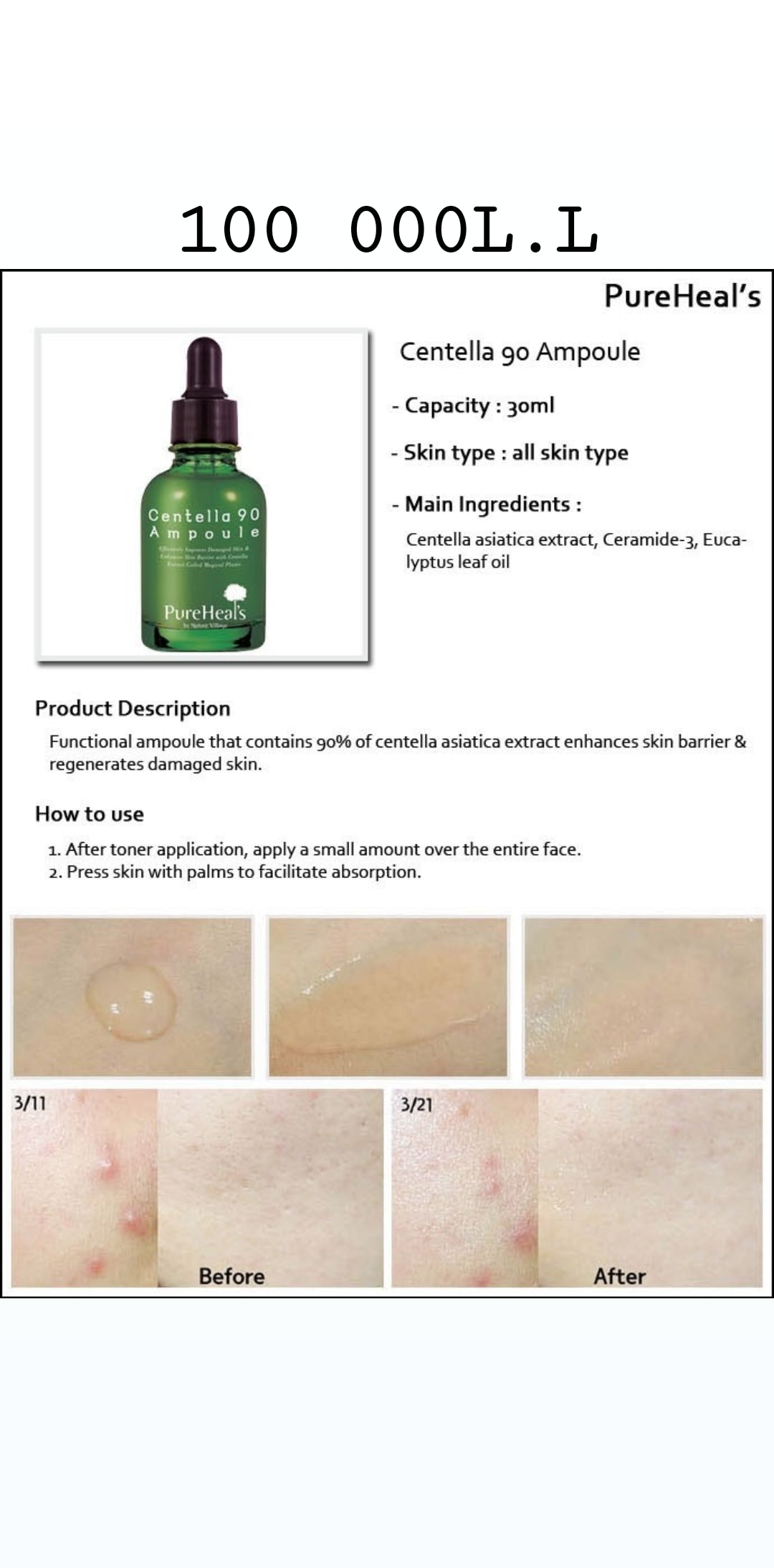 Centella 90 Ampoule - Treatment for acne and marks