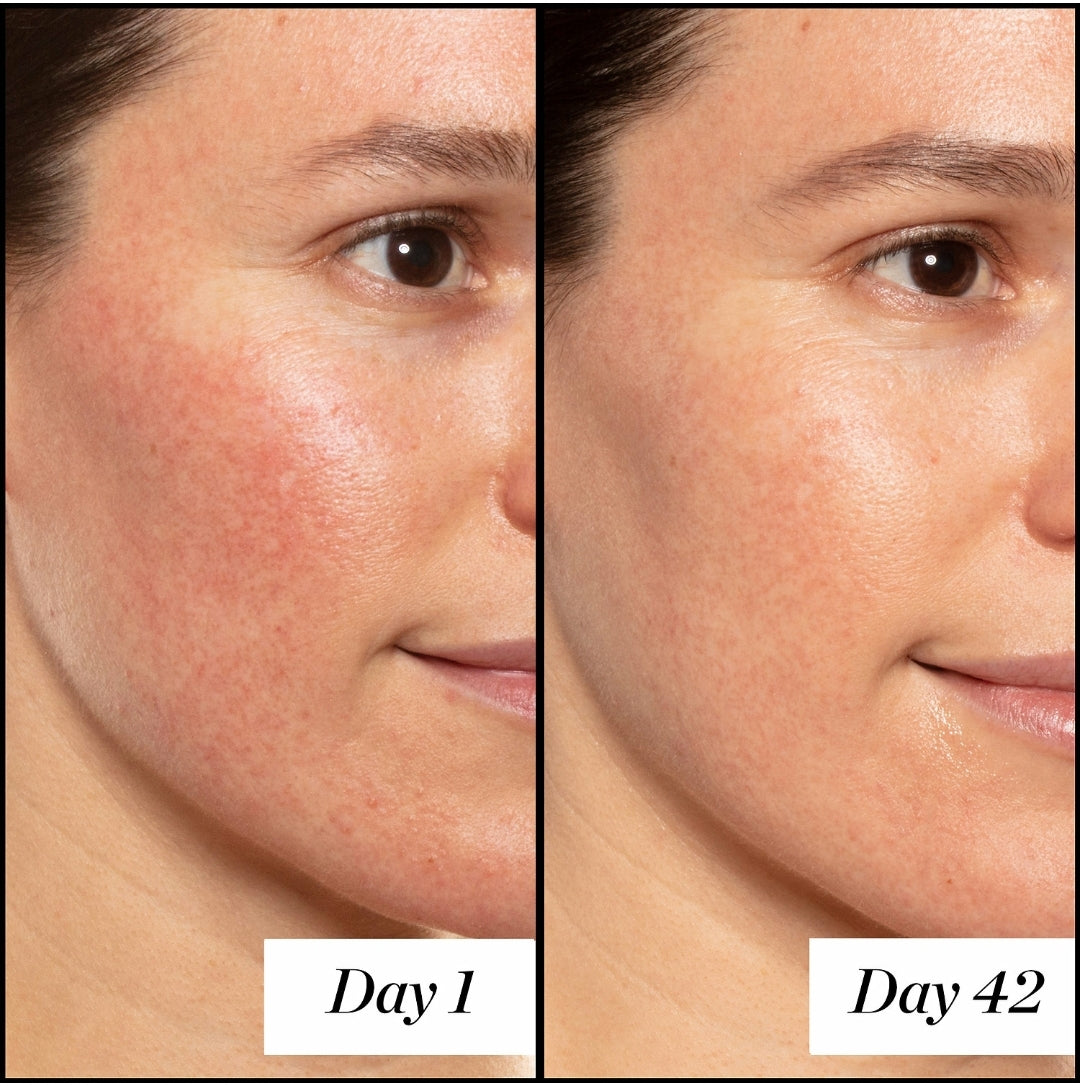 A+ High Dose Retinol Serum Jumbo size