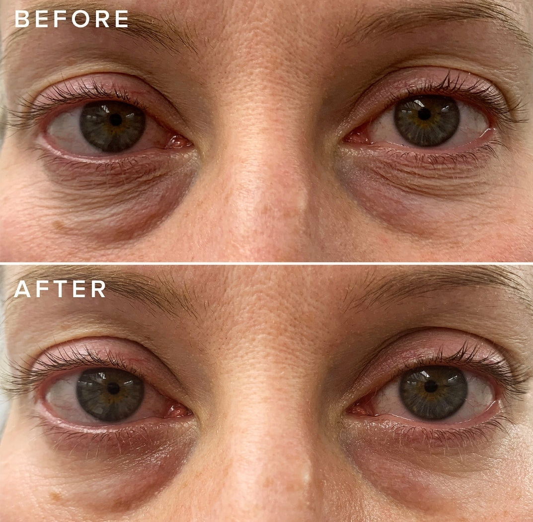 Cheer Up Brightening Vitamin C Eye Cream with Acerola Cherry
