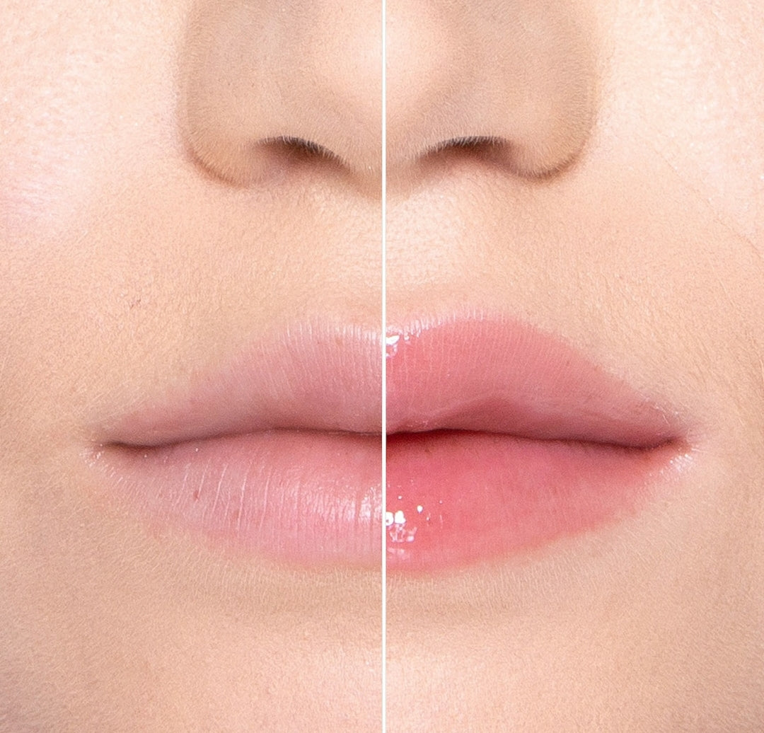 lip injection - Bubblegum yum