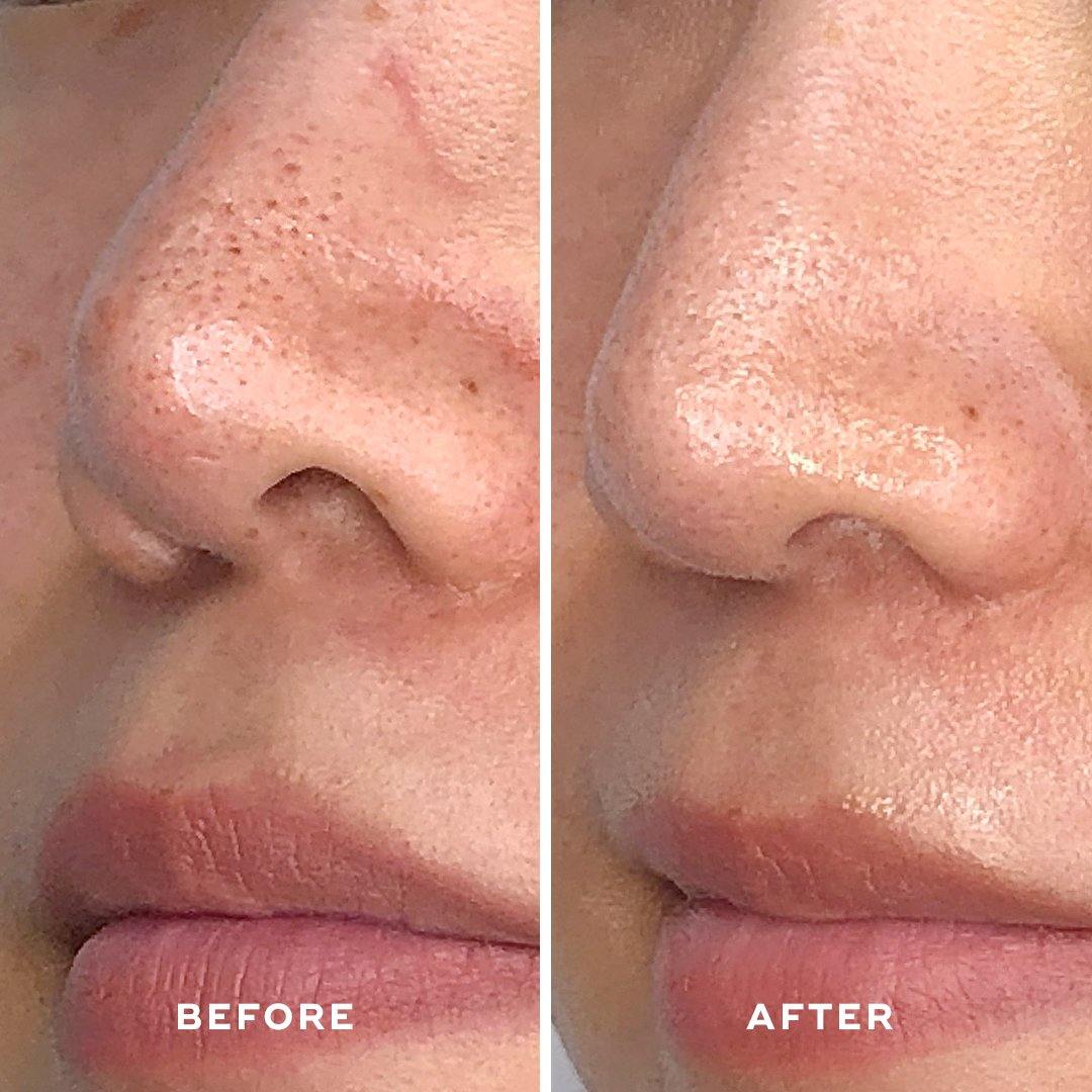 DETOXIFYING TREATMENT MASK