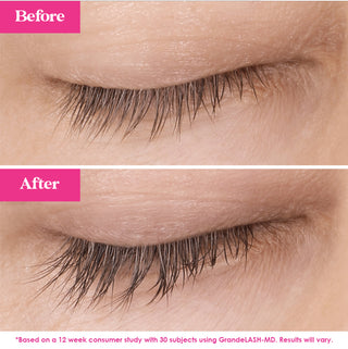 Lash Fix-It Starter Kit